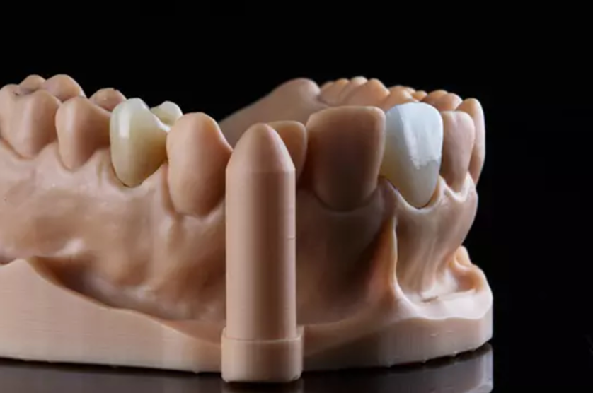 MODEL 2 thumbnail